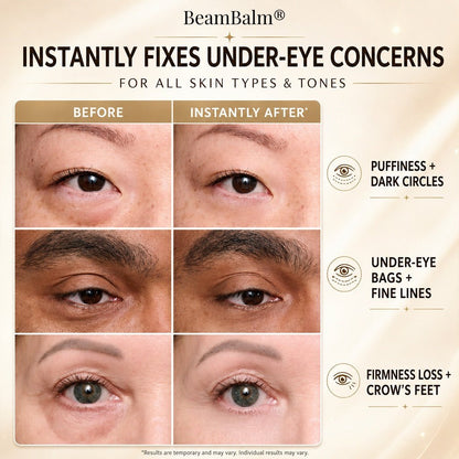 Tensor instantáneo para rostro y ojos BeamBalm®