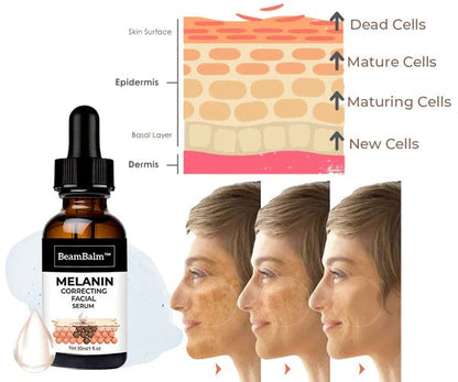 (🔥Last Day Promotion 70% OFF)Fast Dark Spot Remover-BeamBalm™ Melanin Correcting Facial Serum