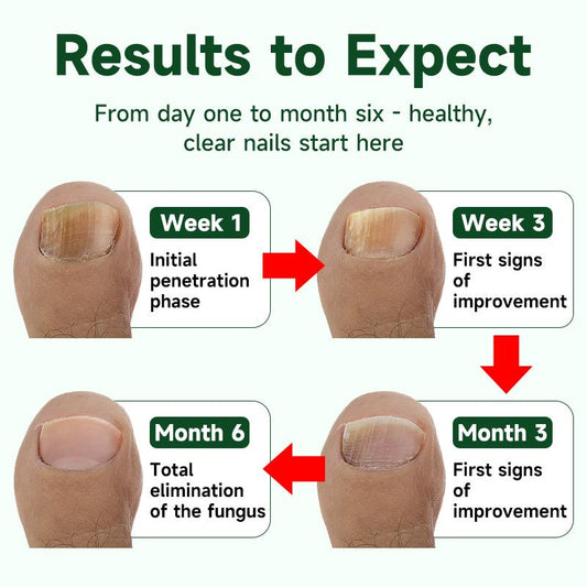 BeamBalm Extra Strength Toenail Fungus Treatment Pen